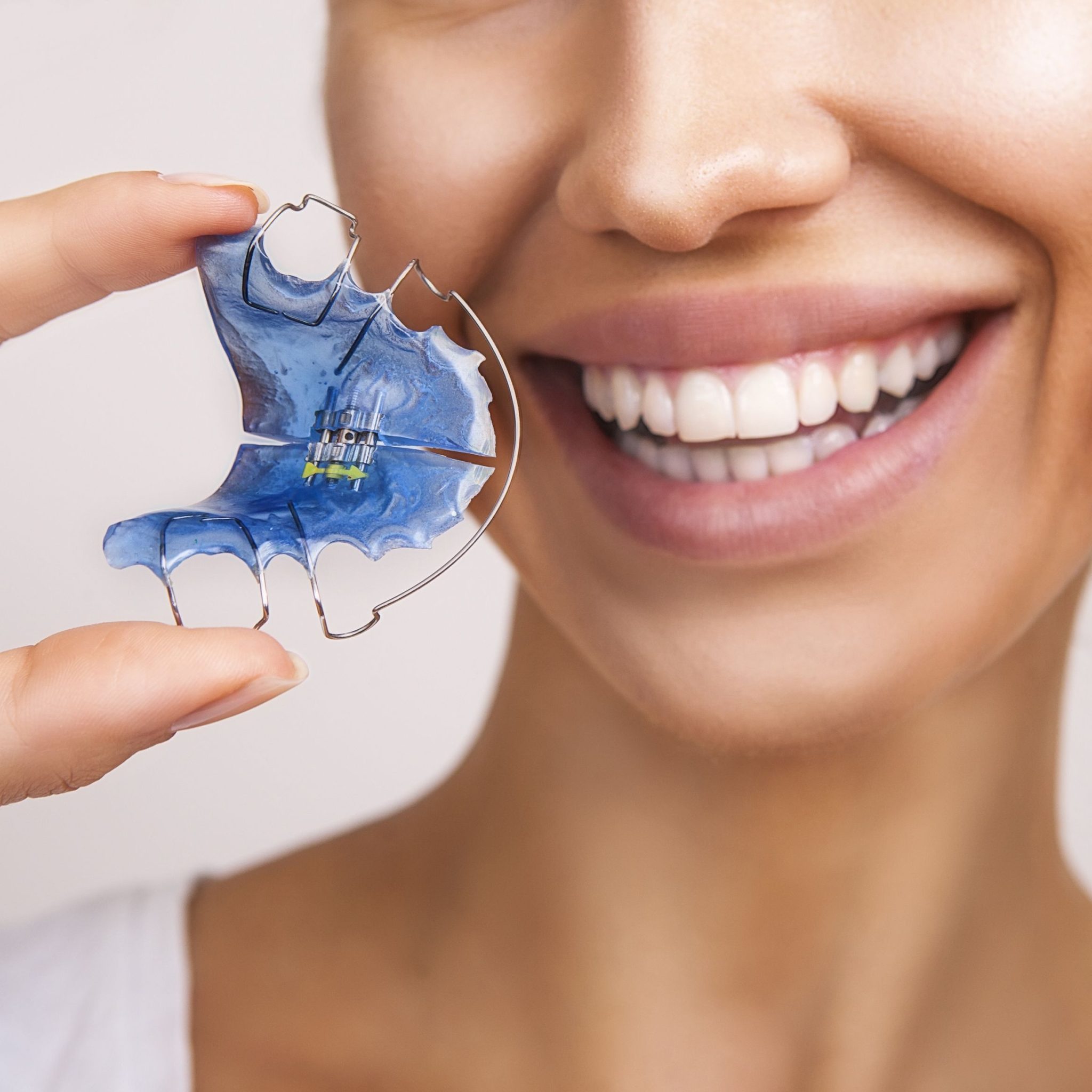 How To Clean & Sanitize Retainers