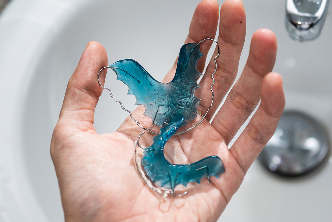 How To Clean & Sanitize Retainers