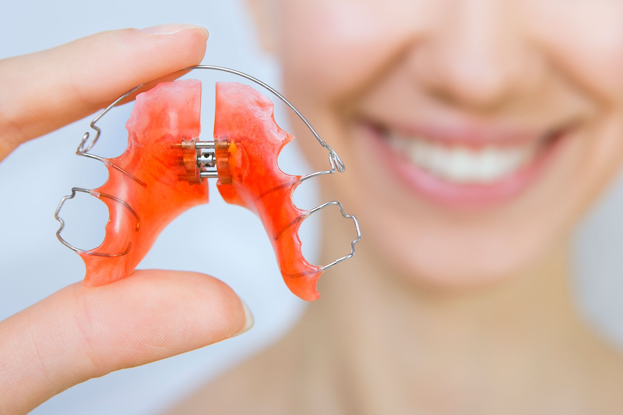 How To Clean & Sanitize Retainers